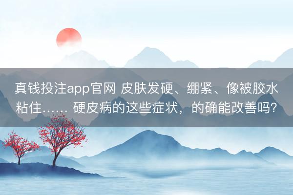 真钱投注app官网 皮肤发硬、绷紧、像被胶水粘住…… 硬皮病的这些症状，的确能改善吗？